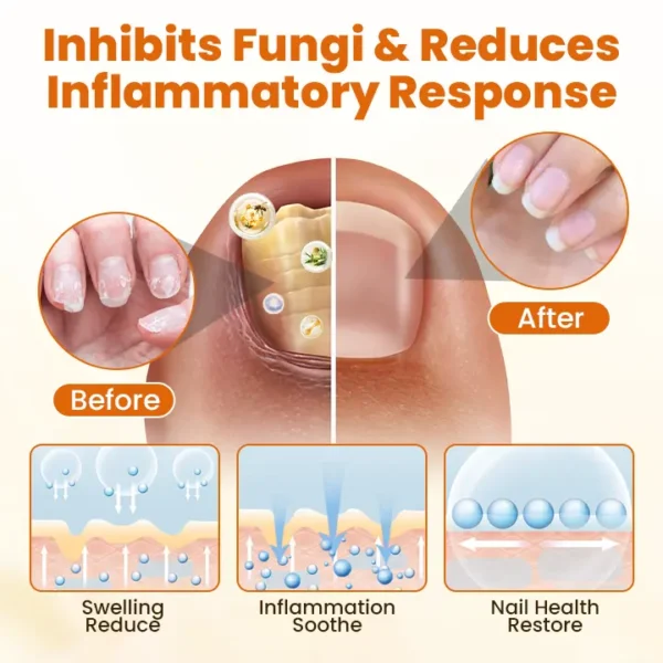 CVREOZ® FungiFix Bee Venom Nail Spray