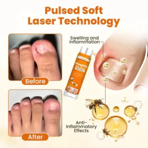 CVREOZ® FungiFix Bee Venom Nail Spray