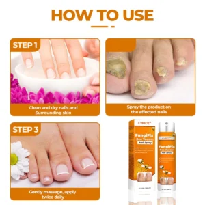 CVREOZ® FungiFix Bee Venom Nail Spray