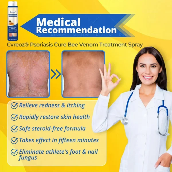 Cvreoz® Psoriasis Cure Bee Venom Treatment Spray