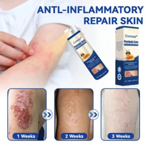 Cvreoz® Psoriasis Cure Bee Venom Treatment Spray