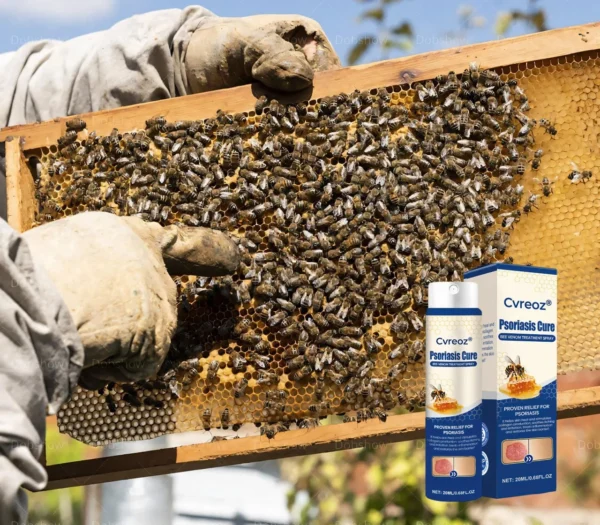 Cvreoz® Psoriasis Cure Bee Venom Treatment Spray