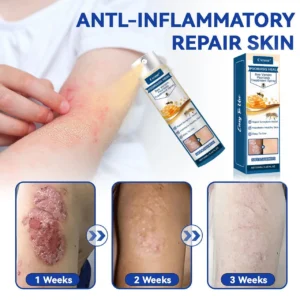 Cvreoz® Psoriasis Heal Bee Venom Spray
