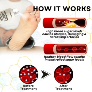 CVREOZ® Bee Venom Diabetic Foot Healing Spray