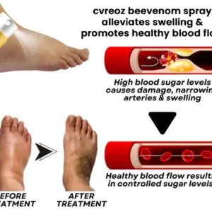 CVREOZ® Bee Venom Diabetic Foot Treatment Spray