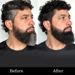 Cvreoz® 3-in-1 Black Hair Dye Shampoo