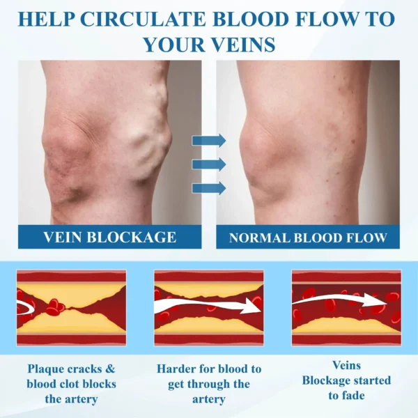 Cvreoz® VeinFocus Microneedle Leg Patch