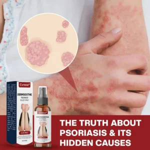 Cvreoz® DermSoothe Psoriasis Relief Spray
