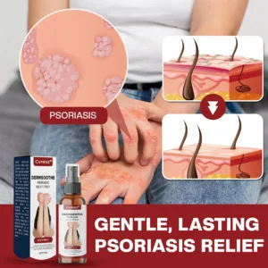 Cvreoz® DermSoothe Psoriasis Relief Spray