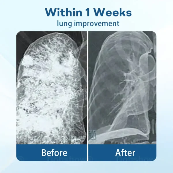 Cvreoz® DoubleNano Advanced Lung Detox Patch for Relief