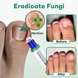Cvreoz® Nail Care Roll-On