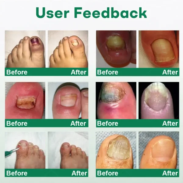 Cvreoz® Nail Care Roll-On