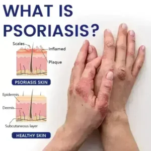 Cougex® DermaSooth Repair Cream