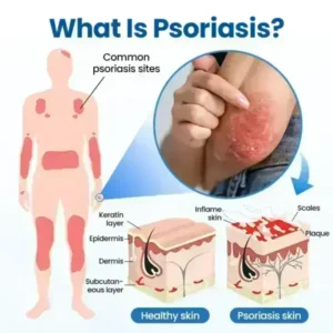 Cougex® PCA Magnesium Deep Repair Spray