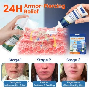 KUBOZN® Psoriasis Day & Night Repair System - 100% Steroid-Free Relief Duo for Plaques, Scaling & Itch